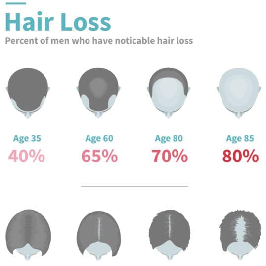 Hair Loss Illustration